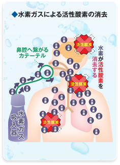 水素ガスによる活性酸素の消去