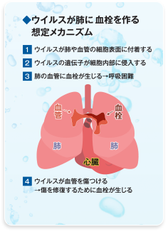 ウイルスが肺に血栓を作る想定メカニズム